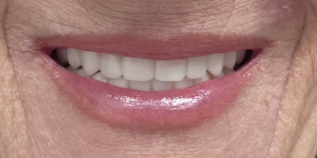 Michigan Dental Implant Studio — photo